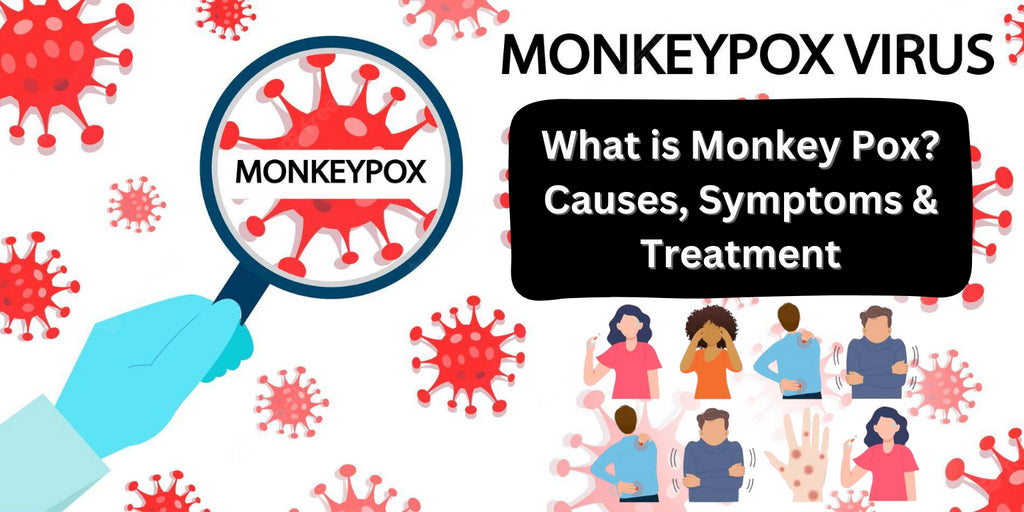What is Monkey Pox? Causes, Symptoms and Treatment