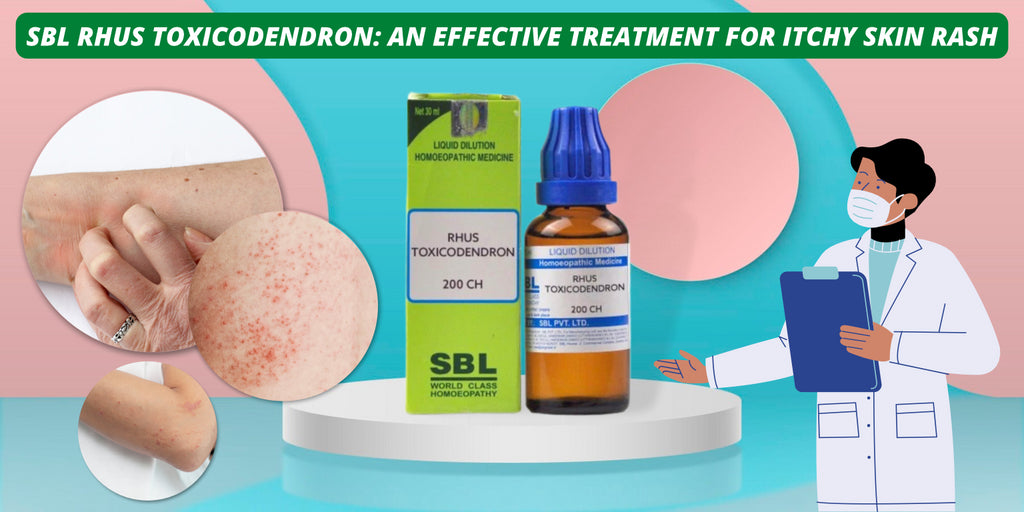 SBL Rhus Toxicodendron: An Effective Treatment for Itchy Skin Rash