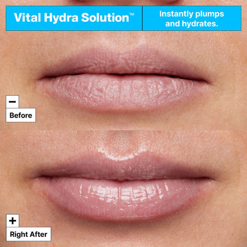 Dr.Jart+ Vital Hydra Solution Hydrating Lip Mask With Hyaluronic Acid