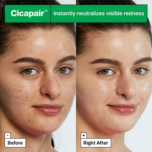 Dr.Jart+ Cicapair Tiger Grass Color Correcting Treatment With Niacinamide