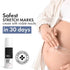 Thriveco Stretch Marks Expert Serum Cream