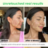 Moraze Cosmetics Skin Reborn 1 Acne Controlling Serum Free Lip Scrub