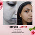 Tvishi Skincare Refresh Skin Bundle