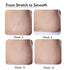 Thriveco Stretch Marks Expert Serum Cream