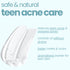 Tuco Acne Face Gel
