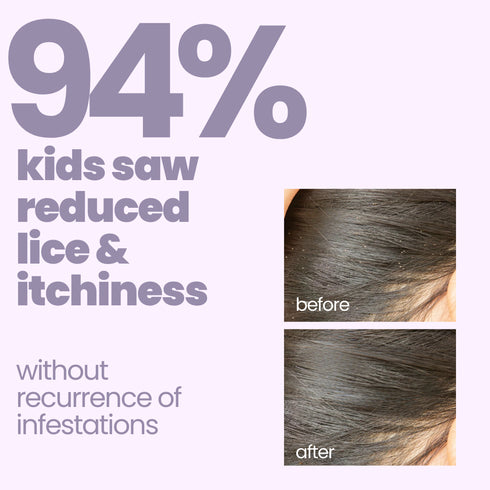 Tuco Anti Lice Shampoo for Kids