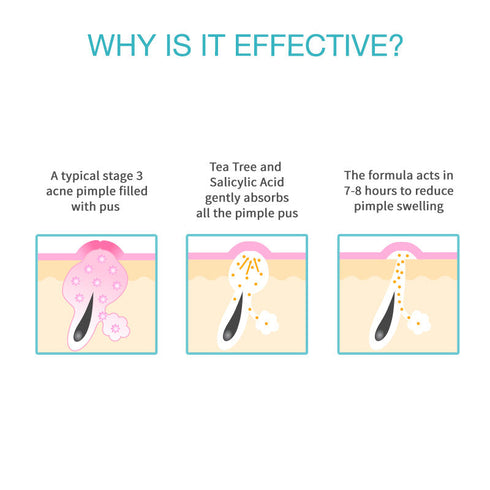 Nykaa Skin Secrets Tea Tree & Salicylic Acid Spot Patch