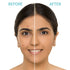 Nykaa Skin Secrets Tea Tree & Salicylic Acid Spot Patch