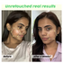 Moraze Cosmetics Skin Reborn 1 Acne Controlling Serum Free Lip Scrub