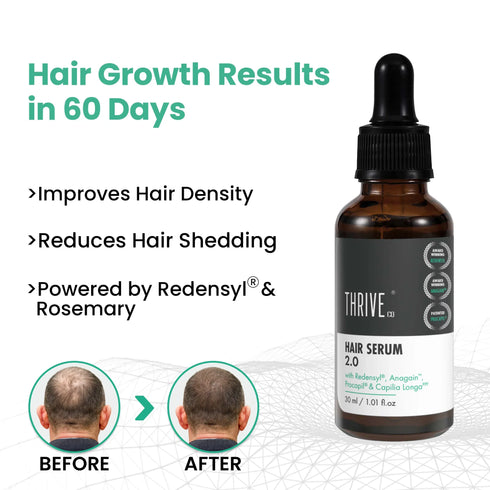 Thriveco Hair Growth Serum for Men & Women 2 0