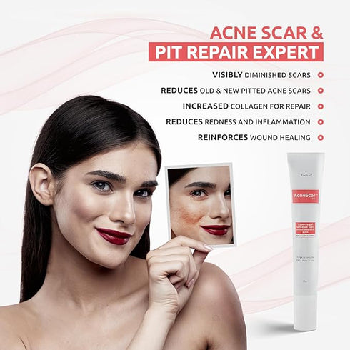 Brinton AcneScar Advanced Gel for Acne Scars