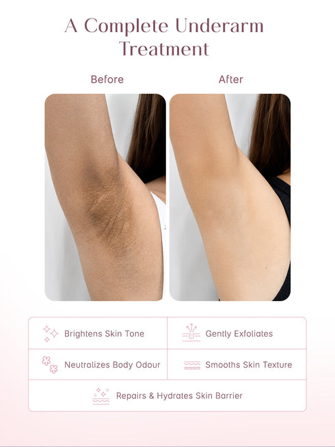 Seoulskin 5% AHA + Kojic Acid Brightening Underarm Roll On