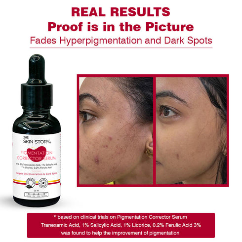 The Skin Story Clear Skin Duo