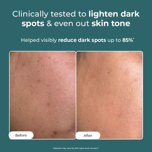 Conscious Chemist Trubiom Pigmentation Corrector Gel Cream 50gm