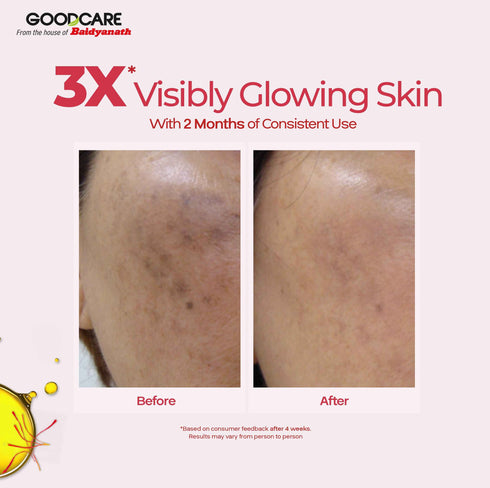 Goodcare Kumkumadi Oil Ayurvedic Night Serum with Kashmiri Saffron