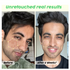 Moraze Cosmetics Skin Reborn 1 Acne Controlling Serum Free Lip Scrub