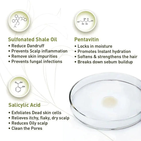 Keya Seth Aromatherapy Scalp care Dandruff Removal Solution with Salicylic Acid
