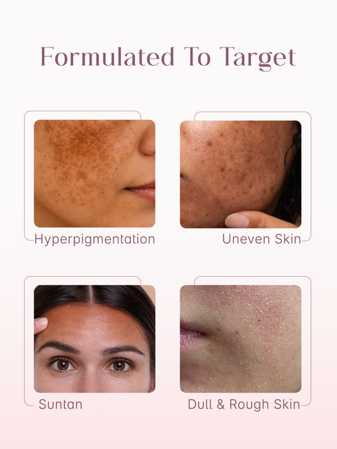 Seoulskin Kojic Acid Skin Lightening Cream