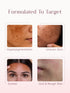 Seoulskin Kojic Acid Skin Lightening Cream