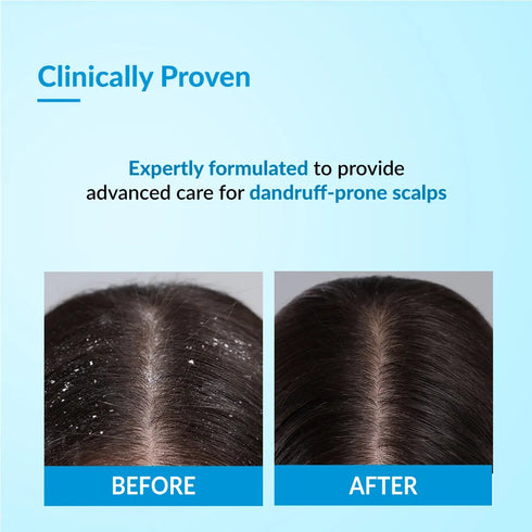 FixDerma Bioteez Advance Shampoo