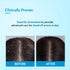 FixDerma Bioteez Advance Shampoo
