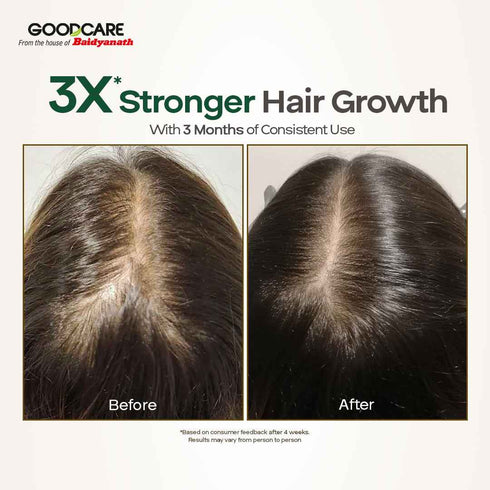 Goodcare Root Boost Hair Oil With Hibiscus & Bhringraj