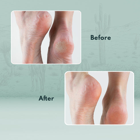 Wildflower Naturals Hand and Foot Cream