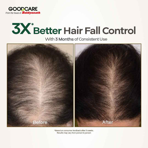 Goodcare Root Boost Hair Oil