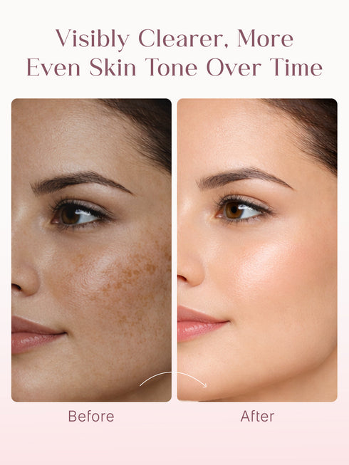 Seoulskin Kojic Acid Skin Lightening Cream