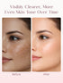 Seoulskin Kojic Acid Skin Lightening Cream