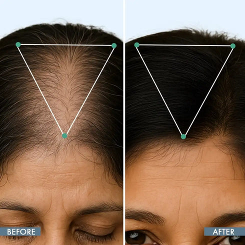 Thriveco Hair Growth Serum 50ml Women's Hair Growth Supplement 60N Women's Balance Hair Supplement 30N