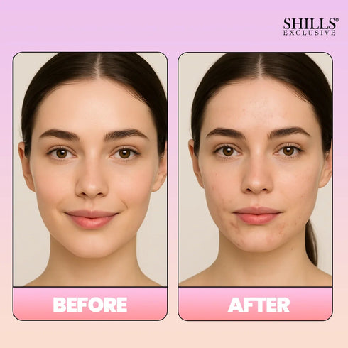 Shills Professional Makeup Remover Mist