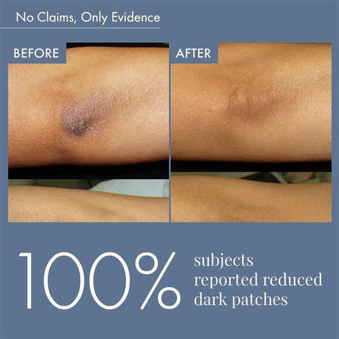 Thriveco Dark Patches Corrector