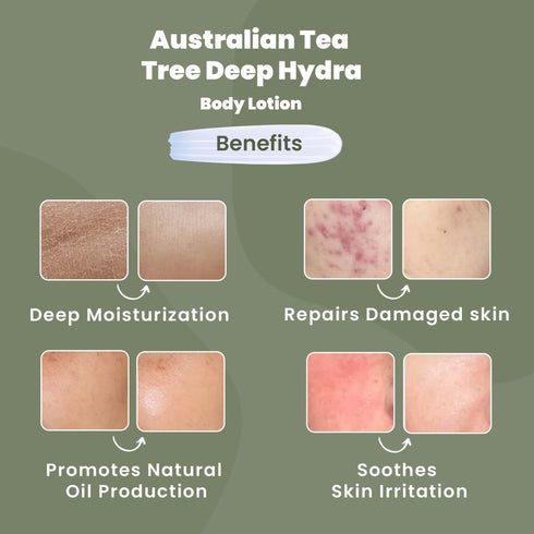 Wild Oak Australian Tea Tree And Shea Butter Body Lotion
