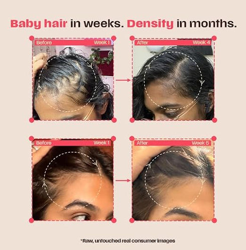 Days Ahead Leave-In Hair Growth Serum 30ml