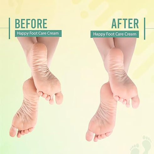 Glamveda Happy Foot Care Crack Cream