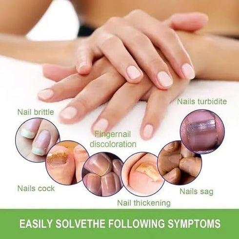 ZeroPathy Ayurvedic Nail Strengthening Lotion