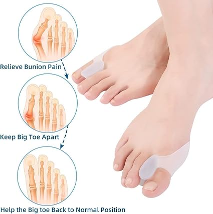 Suefor Bunion Corrector Silicone Toe Separators For Fast Pain Relief