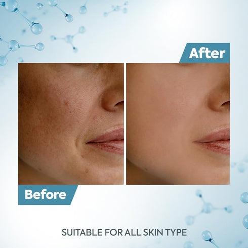 Raaga Professional DeTan Tan Removal Cream