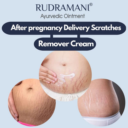 RUDRAMANI Auyrvedic Malam Cream