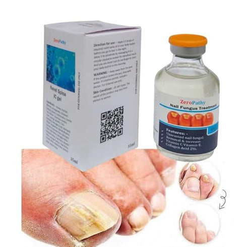 ZeroPathy Ayurvedic Nail Strengthening Lotion