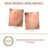 The Skin Stroy Pimple & Acne Corrector Gel