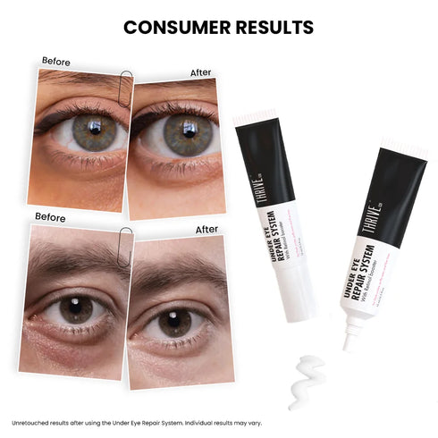 ThriveCo Undereye Repair System