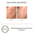The Skin Story Pimple Control Combo Clear Glowing Skin