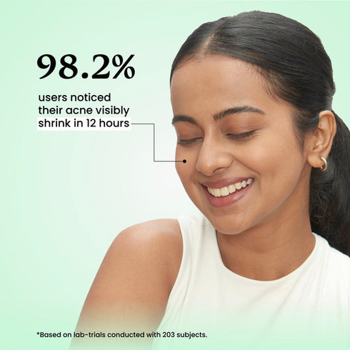 Acne Spot Corrector with Salicylic Acid