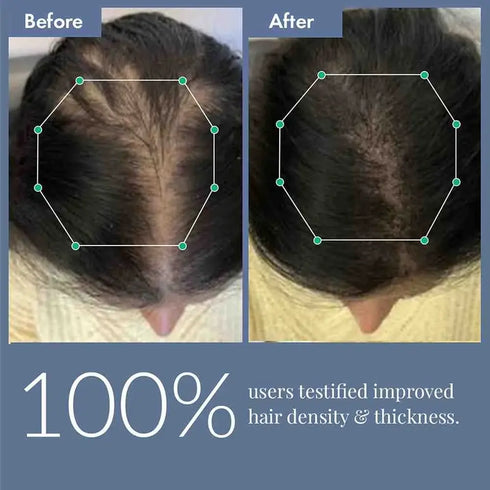 Thriveco Hair Growth Serum 2 0 For Men & Women