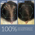 Thriveco Hair Growth Serum 2 0 For Men & Women