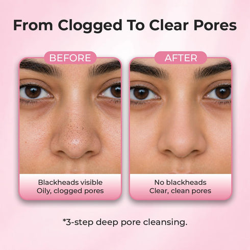 Sanfe Aloe Vera 3 Step Nose Kit