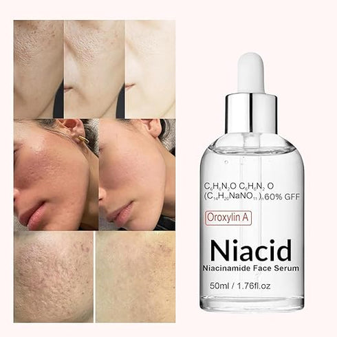 Niacid Skin Refining Serum – Controls Oil & Helps Reduce Acne Marks 30ml