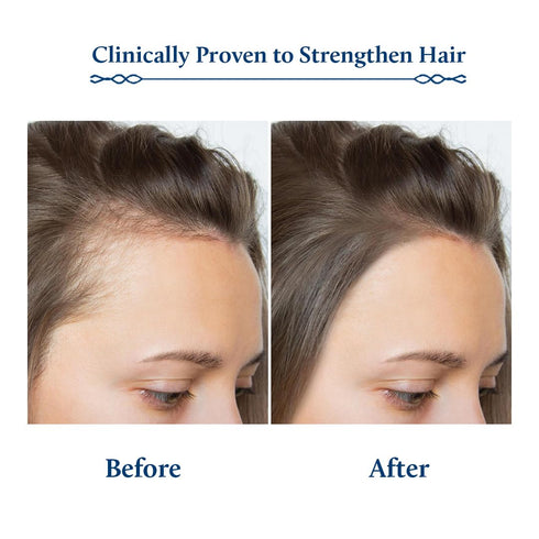 Blue Nectar Hair Fall Control Shampoo for Hair Growth